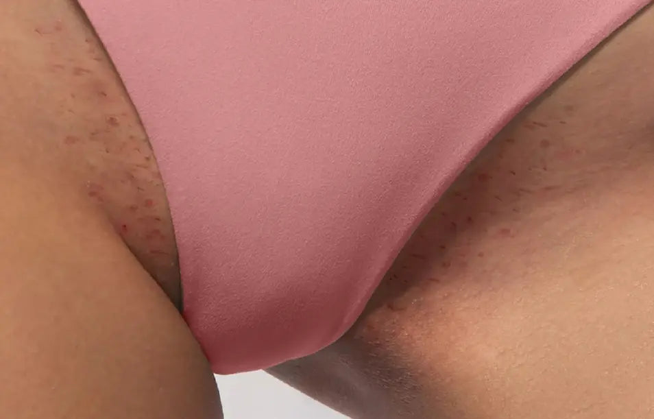 Describes the appearance of the image